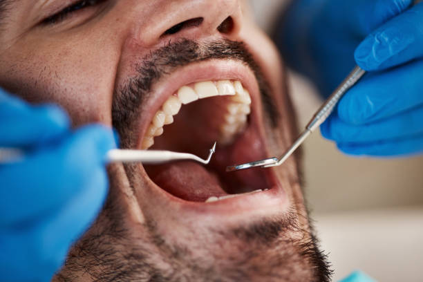 Best Emergency Dental Care for Broken or Chipped Teeth in Iona, ID